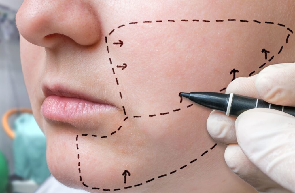 Hand drawing lines with marker on the face of a person who is concerned about their jowls